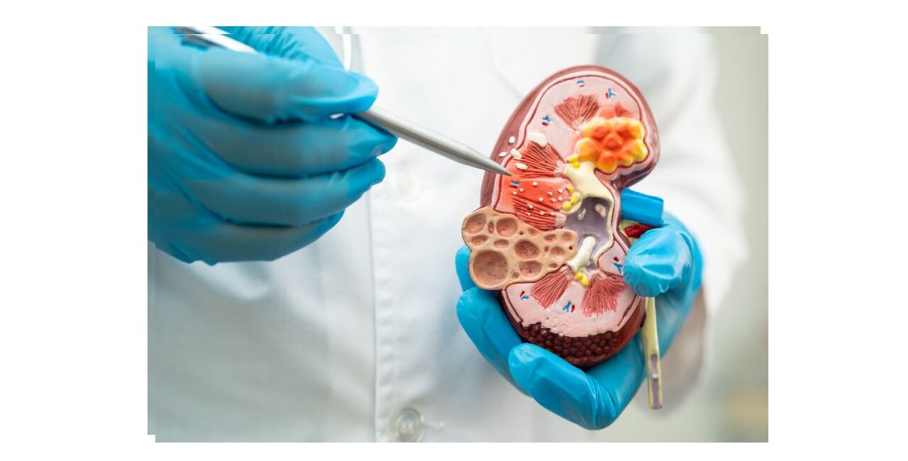 Fibrosis Pulmonar Idiopática y Esclerosis Sistémica: enfermedades raras y asfixiantes