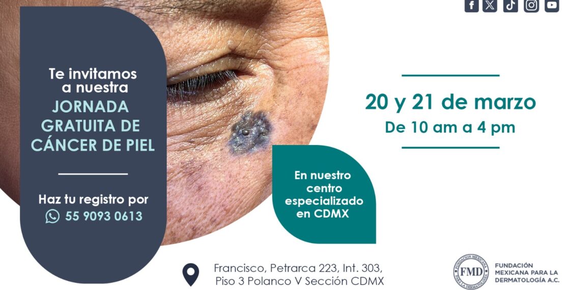 Anuncian jornada gratuita de detección de cáncer de piel en CDMX los próximos 20 y 21 de marzo